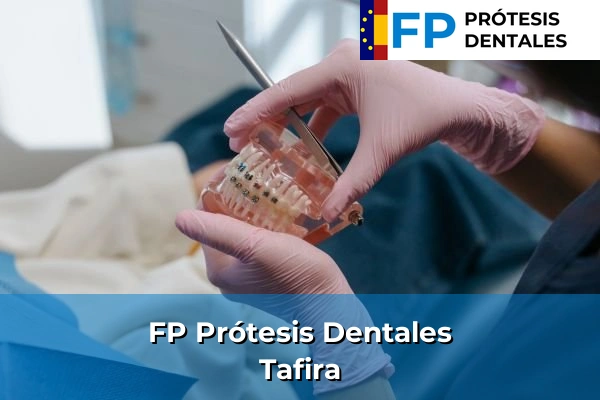 FP Prótesis Dentales en Telde 58 FP Prótesis Dentales en Tafira